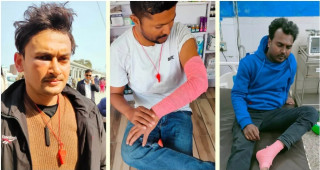 नोबेलमा मेडिकल कलेजमा आन्दोलनरत विद्यार्थी र सुरक्षा गार्डबीच झडप हुदा चार विद्यार्थी घाइते।